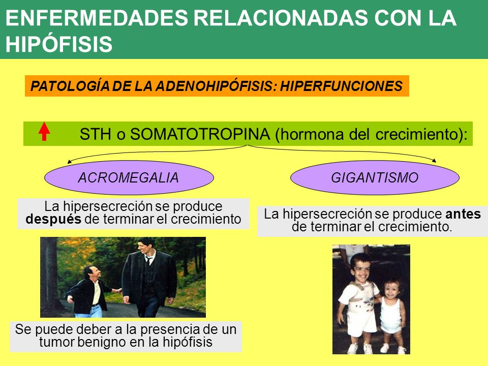 hormona de crecimiento hipersecreción diabetes insípida